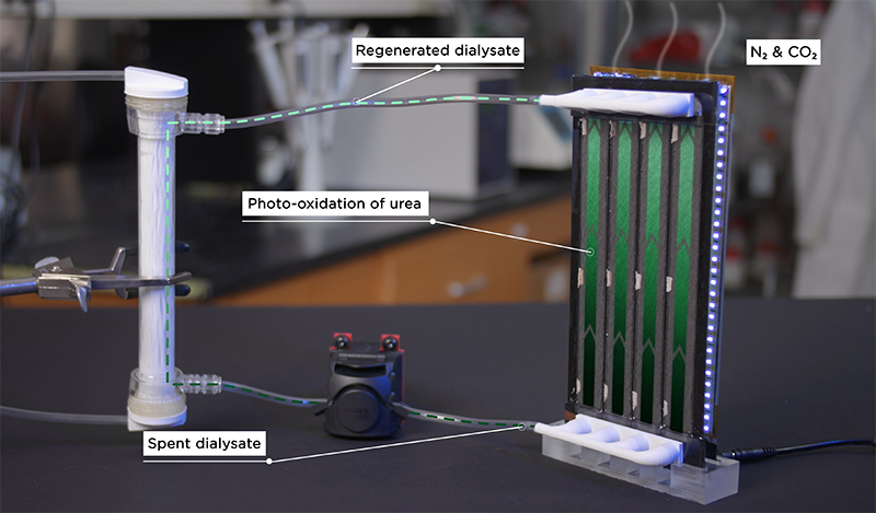 picture of the artificial kidney designed process to recirculate dialysate