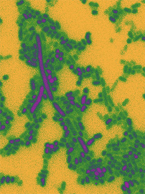 microscopic stained image of bacteria