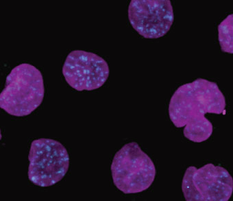 microscopic image of blood cells with DNA damage