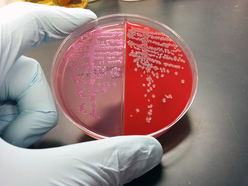 E.coli-selective agar (pink) and blood agar (red) for growing these bacteria in the lab. Credit: Sokurenko Lab.
