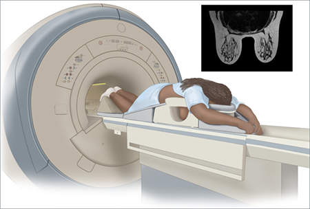 illustration of breast MRI procedure