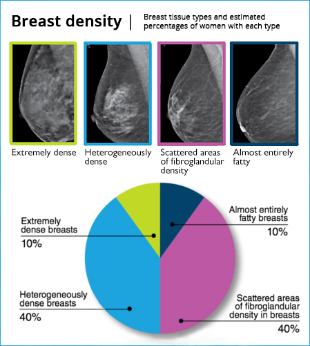 chart of different breast densities