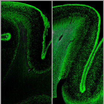 two images showing distribution of aqualorin-4 in brain