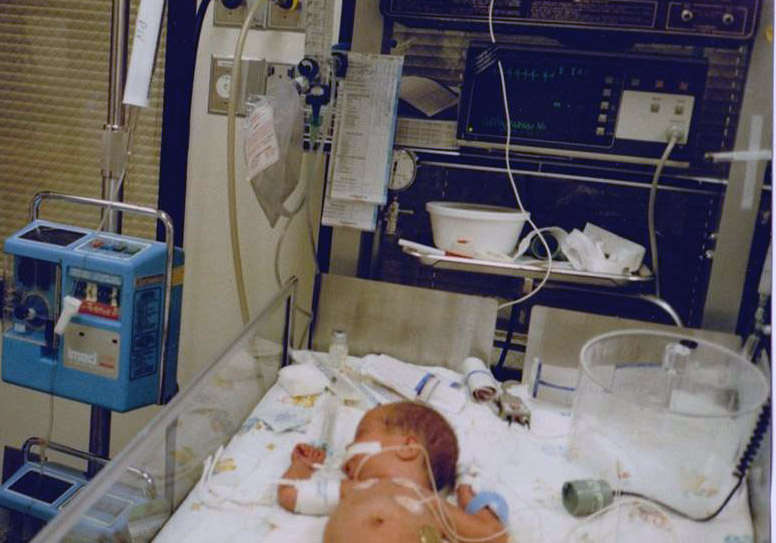 Jamie Wright as infant in NICU