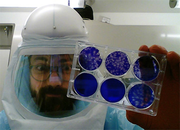 picture of Jesse Erasmus holding SARS-CoV-2 plaques