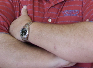 Merkel Cell Carcinoma on man'