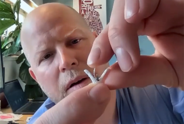 Dr. James McCabe displays a MitraClip like the one he removed from John Steenmeyer.