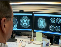 Williams looks over scans of an adult patient with hydrocephalus.