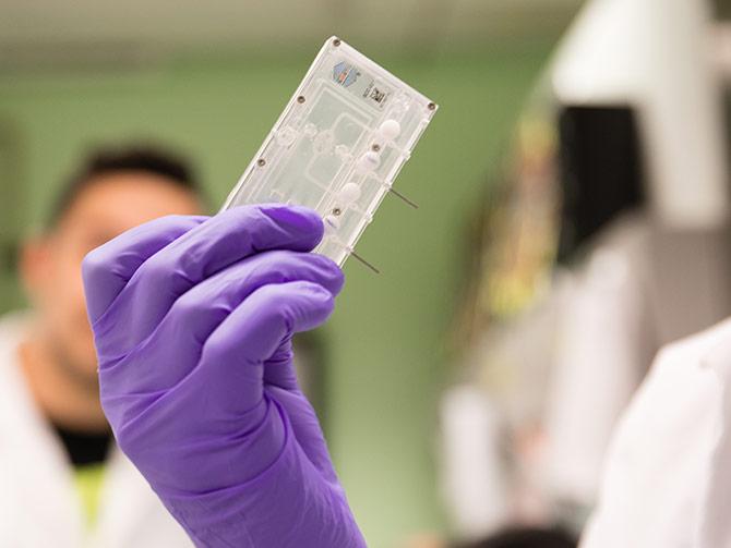 Media Name: 09122017-kidneychip.jpg