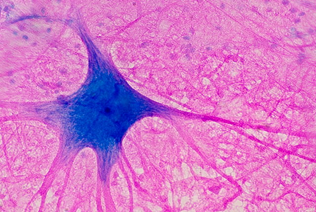 A spinal cord motor neuron
