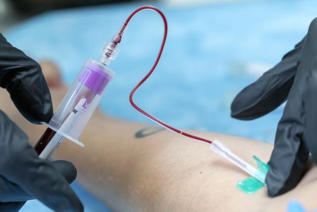 clinical lab blood draw for complete cell count