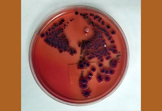 Lab dish culture of Shigella, a gut pathogen