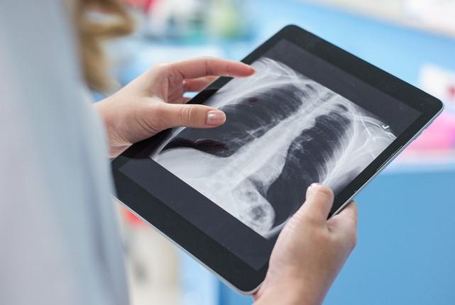 woman looking at x ray on tablet