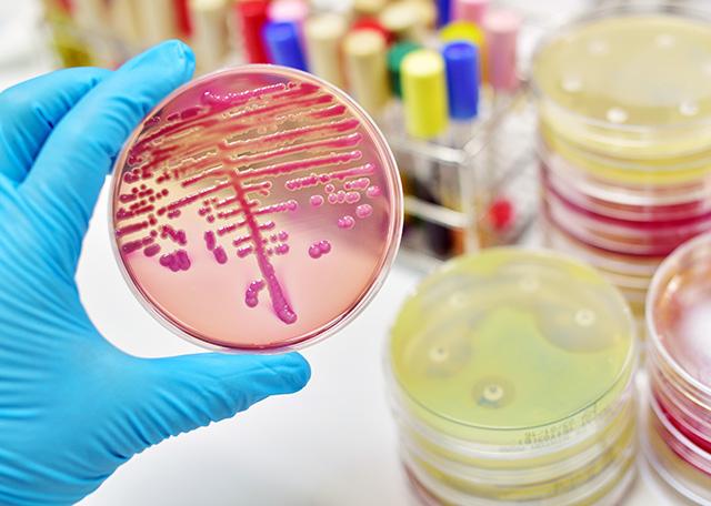 Media Name: bacterial_cultures_gettyimages-499775068.jpg