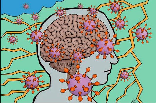 Media Name: covid_on_the_brain_sized.jpg
