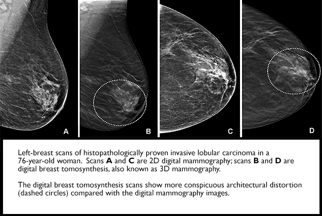 Media Name: dbtvs2dmammo.png