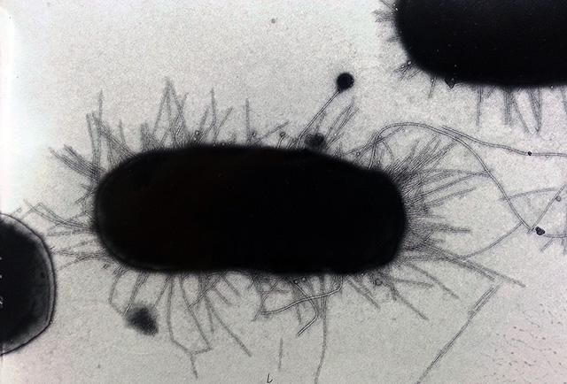 Media Name: e._coli_bacteria_smaller_3.jpg