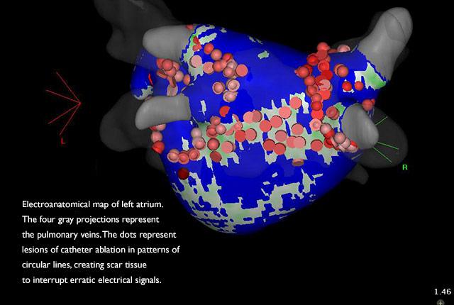 Media Name: la_photo_for_press_release.jpg