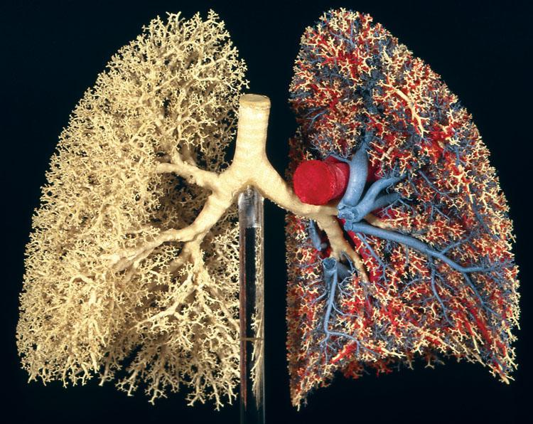 Media Name: lung_image_2.jpg