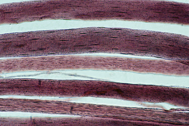 Media Name: muscle_cells_cropped_mccarthy_thumbnail_screenshot_2023-02-28_at_12.11.00_pm.png