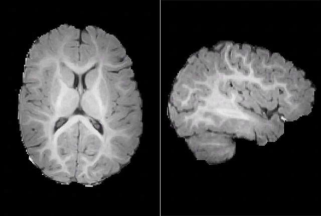 Media Name: new_mri_babies.jpg