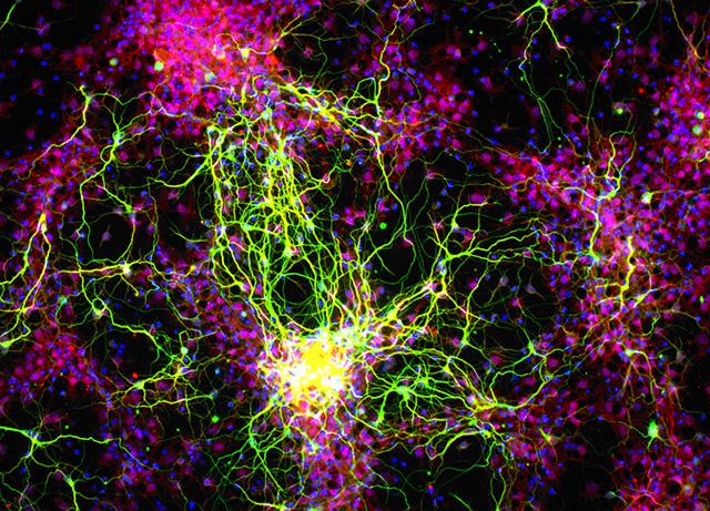 Media Name: retinal_ganglion_cells_cropped.jpg