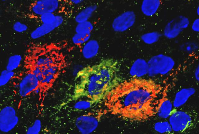 Media Name: schwartz_pnn_image_1_hd_cropped3.jpg