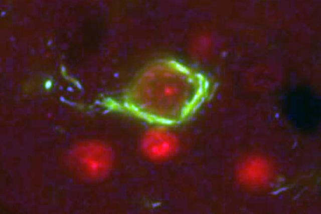 Media Name: tau_cropped_2_kraemer.jpg