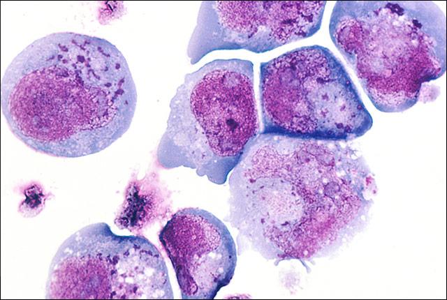 Media Name: xhhv-6-greninger.jpg